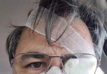 ТАТЬЯНА ЖДАНОК: ДЕПУТАТЫ ЕВРОПАРЛАМЕНТА БУДУТ ТРЕБОВАТЬ ОТ УКРАИНСКИХ ВЛАСТЕЙ НАКАЗАНИЯ ВИНОВНЫХ В НАПАДЕНИИ НА ЖУРНАЛИСТА РУСЛАНА КОЦАБУ