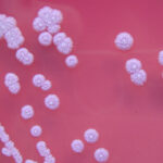 Burkholderia pseudomallei